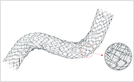 Stent Biliar D Descoberto
