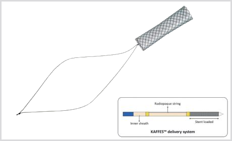 Stent Biliar KAFFES