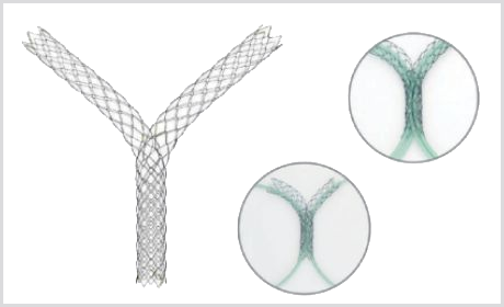 Stent Biliar LCD
