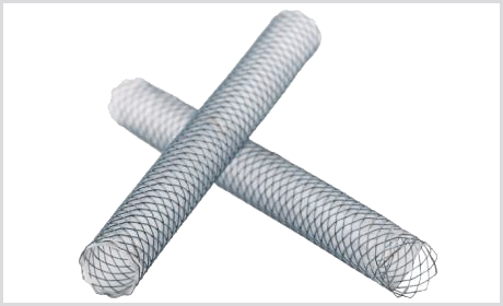 Stent Biliar S coberto e parcialmente coberto