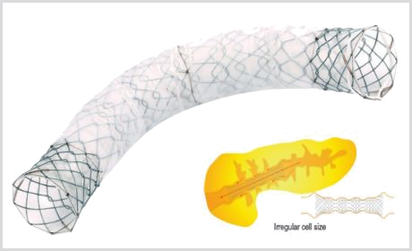 Stent Biliar Pancreático BUMPY