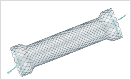 Stent Esofágico S