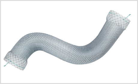 Stent Esofágico MEGA