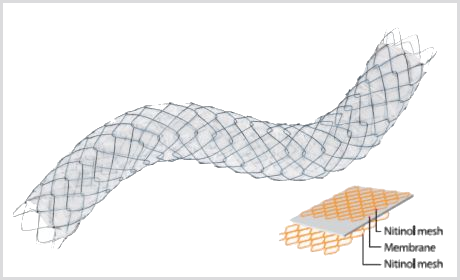 Stent Biliar COMVI